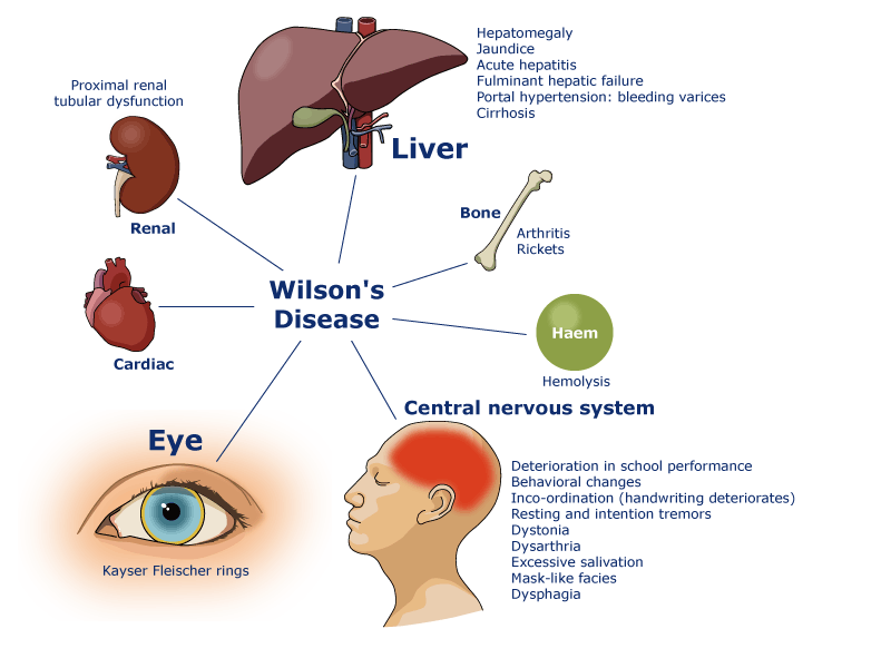 Medical Addicts: Clinical Features in Patients with Wilson Disease